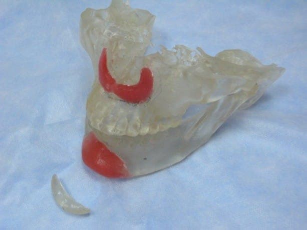 Maxillofacial surgery